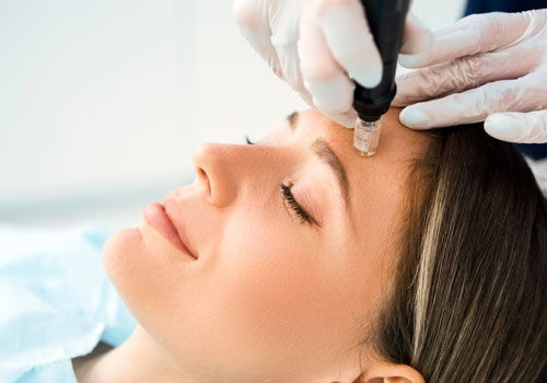 Microneedling Services by Rugby Aesthetics